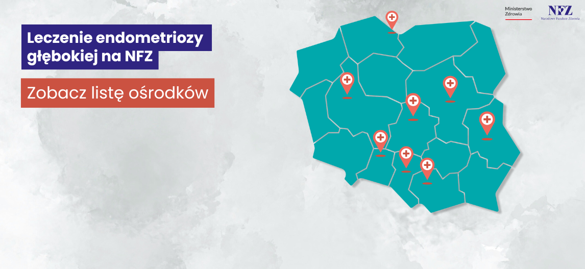 Leczenie endometriozy głębokiej na NFZ